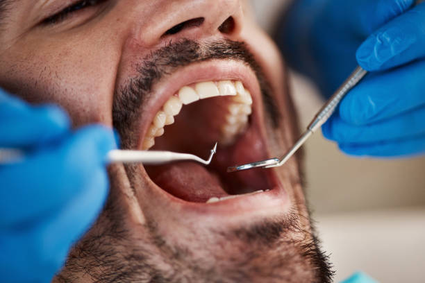 Best Emergency Treatment for Toothache in Green Level, NC